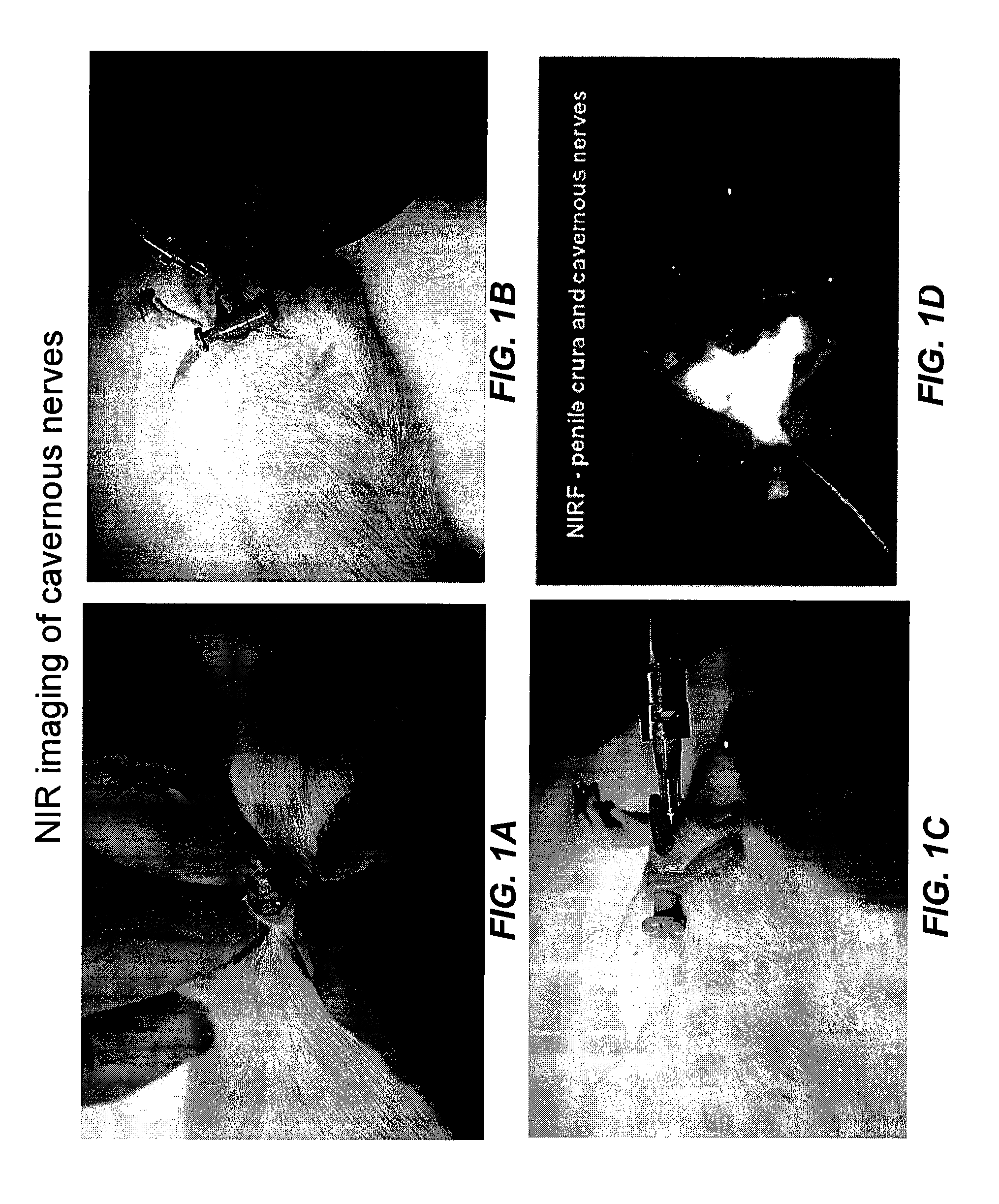 Intraoperative determination of nerve location