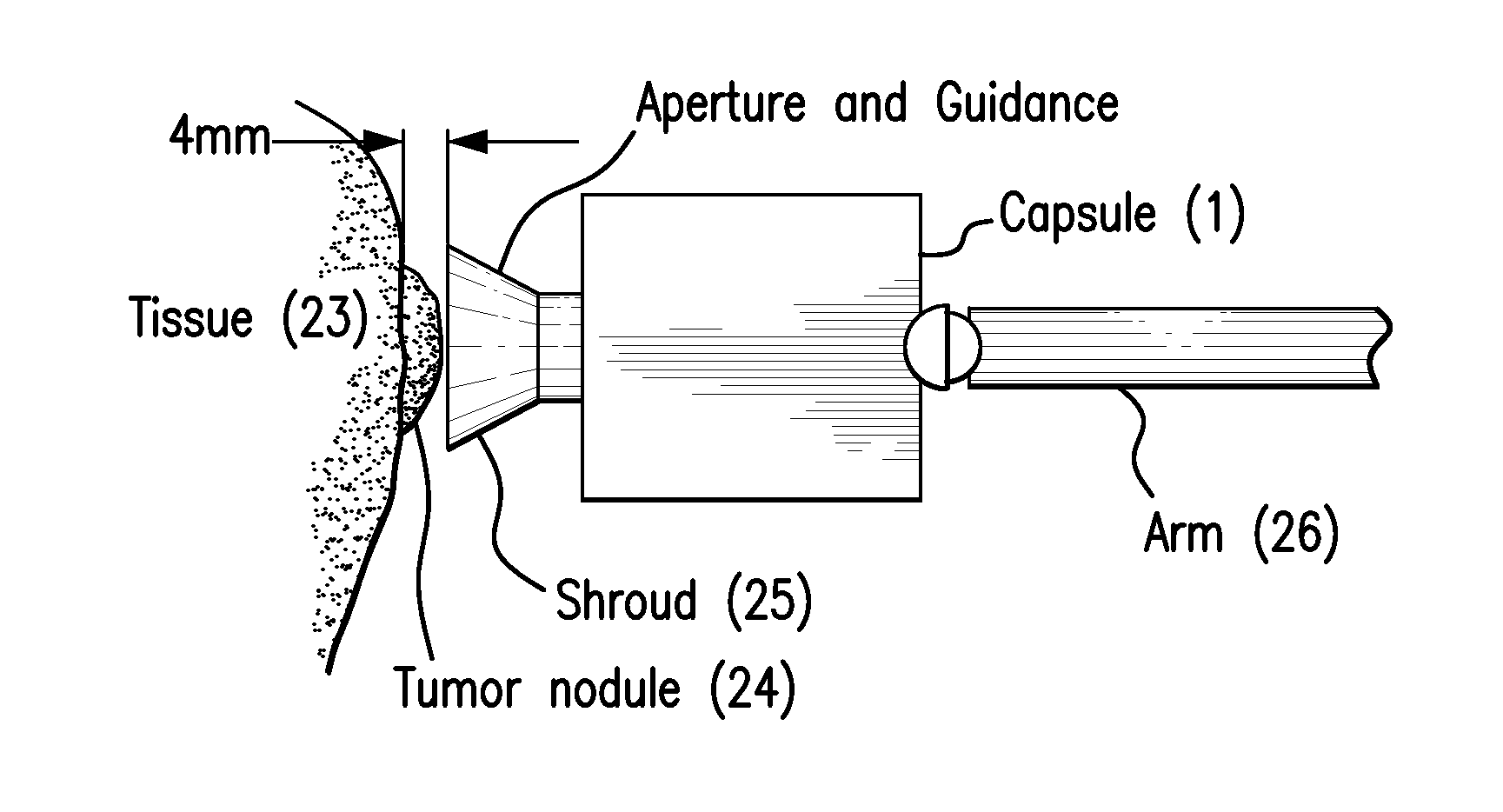Direct visualization Robotic Intra-Operative Radiation Therapy Device with Radiation Ablation Capsule and Shutter System
