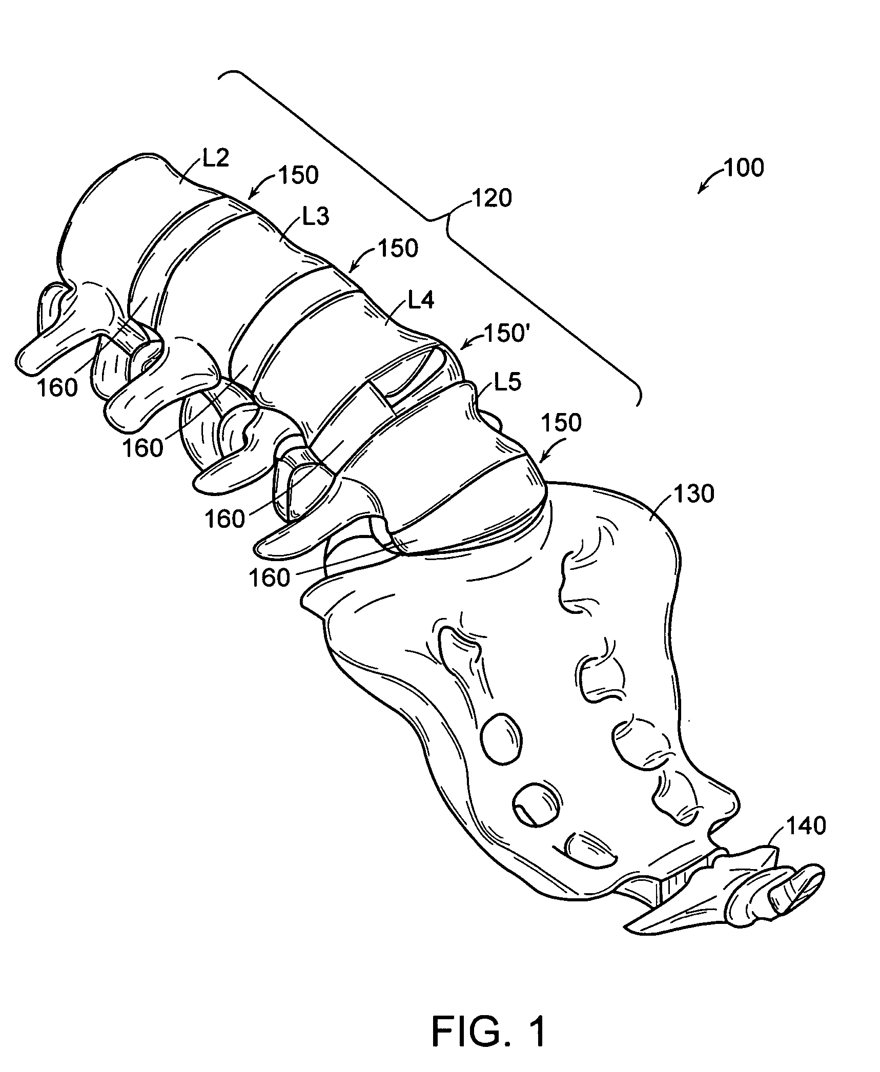 Distraction instrument and method for distracting an intervertebral site