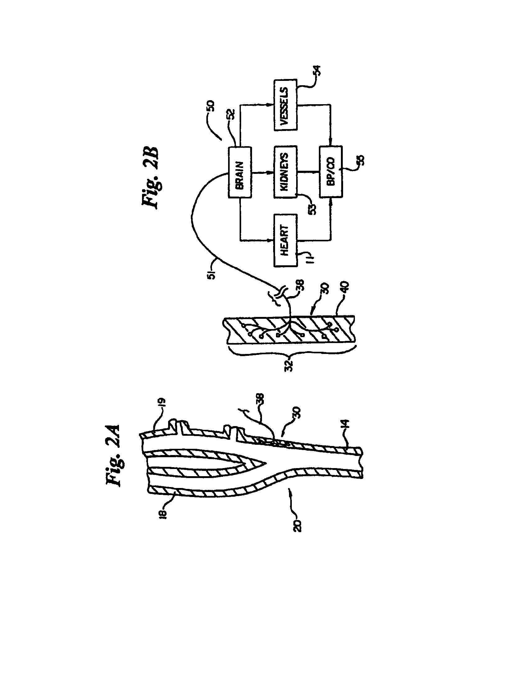 Electrode designs and methods of use for cardiovascular reflex control devices
