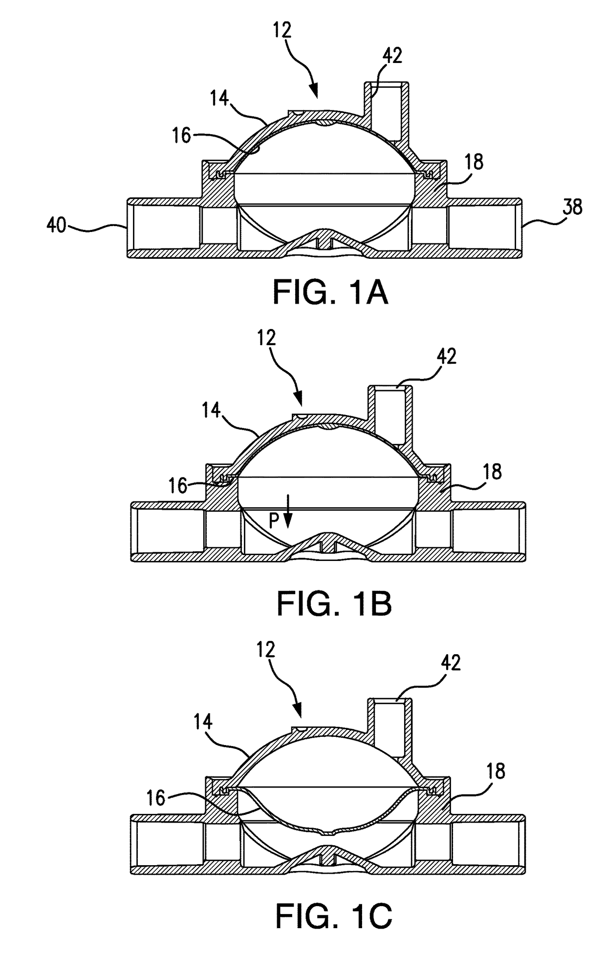 Pressure output device for extracorporeal hemodialysis machine