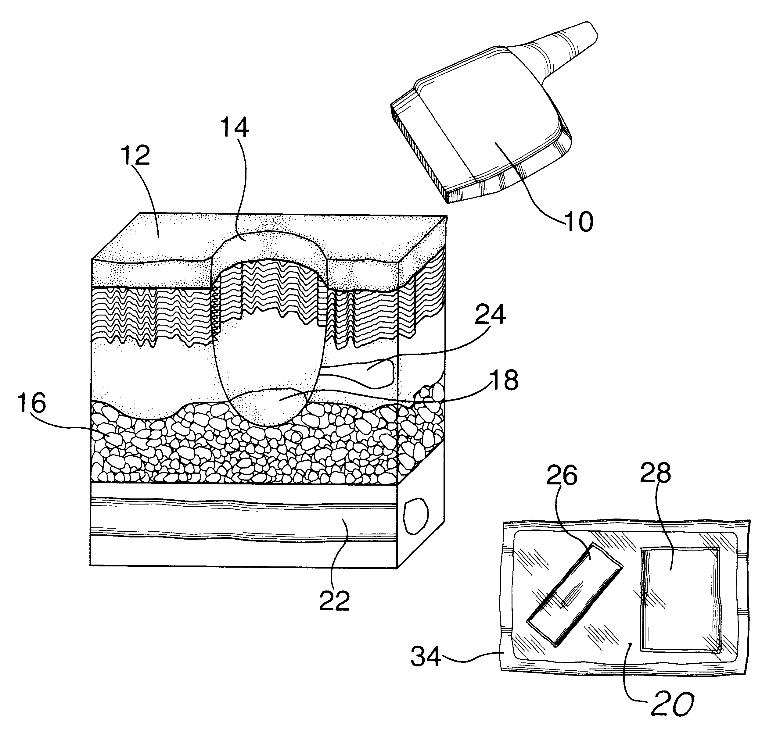 Method and kit for wound evaluation