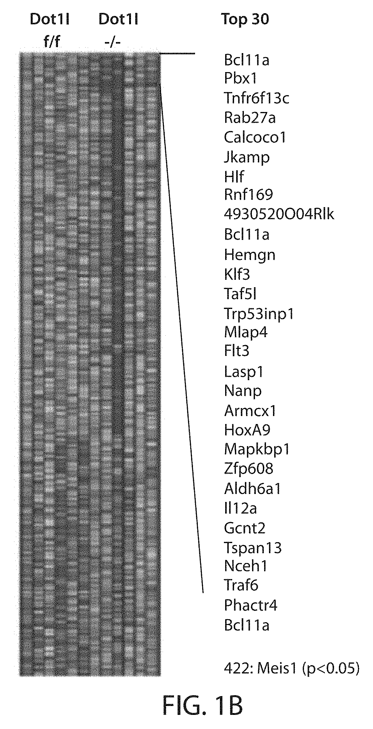 Dot1l inhibition in patients with mn1-high aml