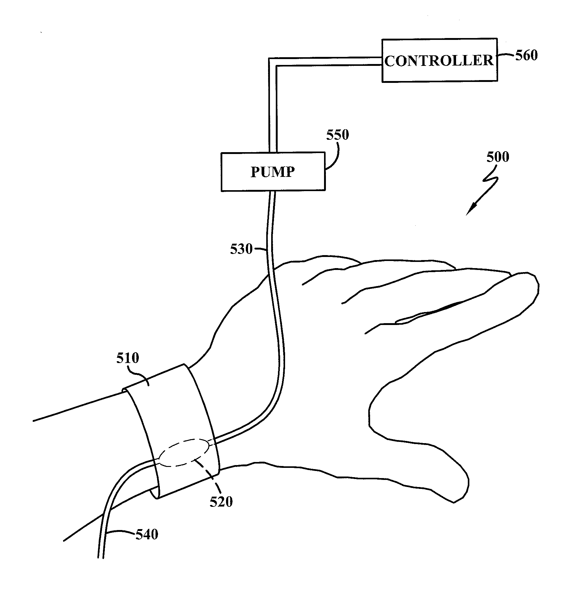 Device And Methods For Medical Training Using Live Subjects