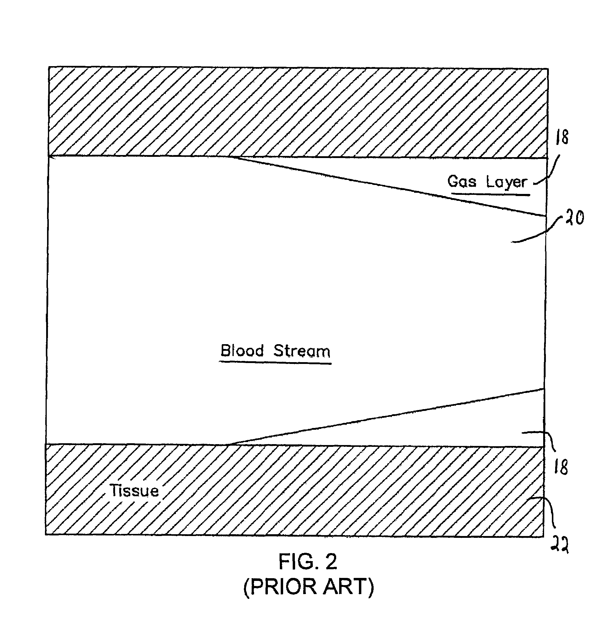 Dive computer and method for determining gas formation
