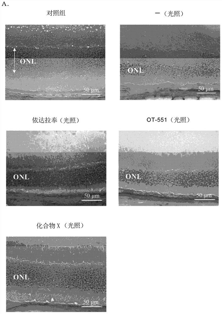 Pharmaceutical composition for intraocular or oral administration for treatment of retinal diseases
