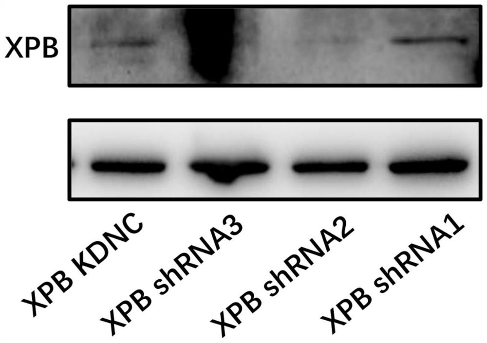 Substance for inhibiting XPB expression and endothelial cell line with XPB low expression