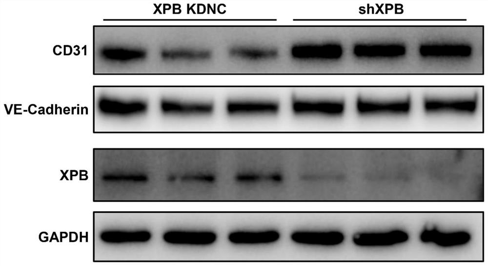 Substance for inhibiting XPB expression and endothelial cell line with XPB low expression