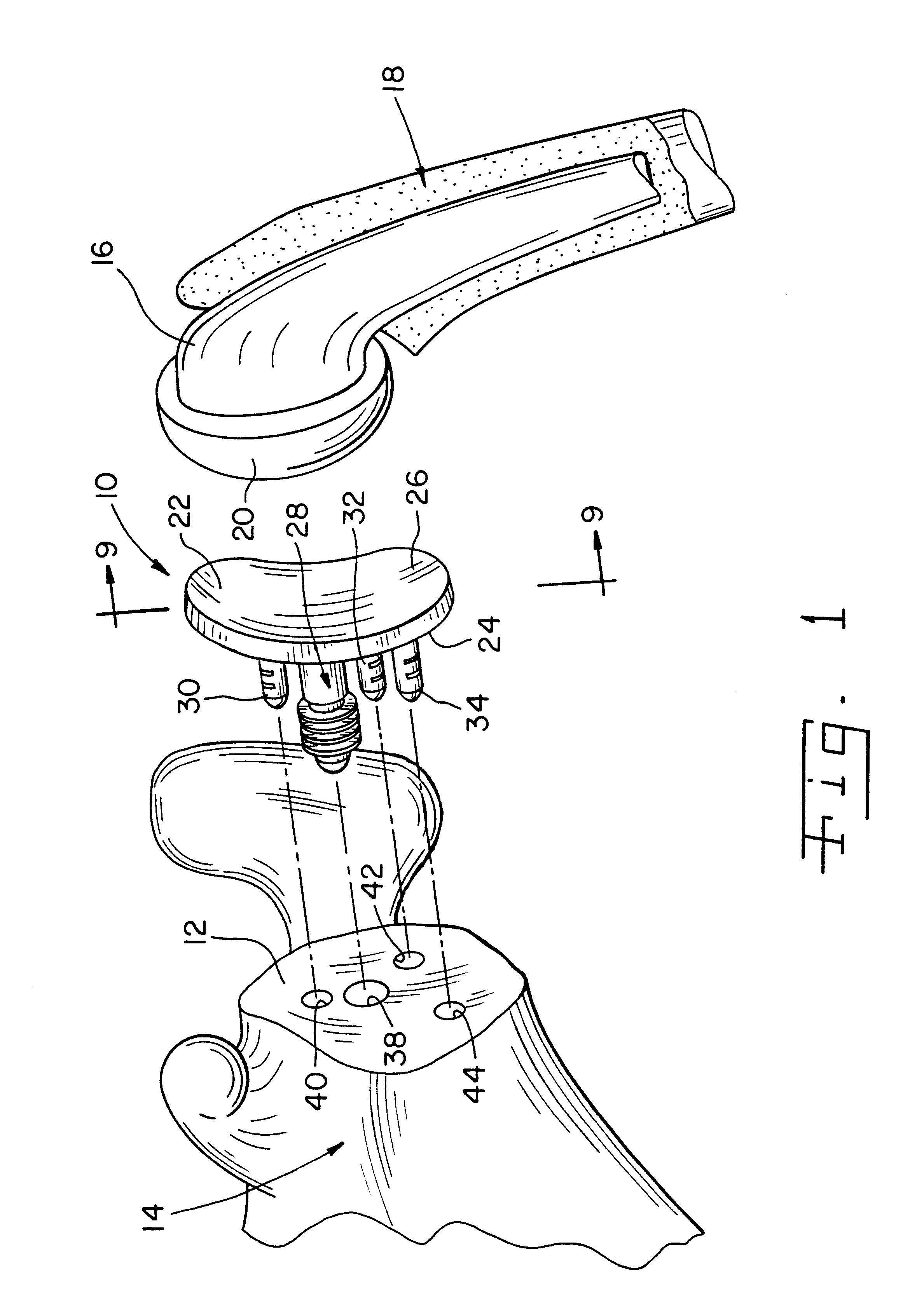Apparatus and method for securing a cementless glenoid component to a glenoid surface of a scapula