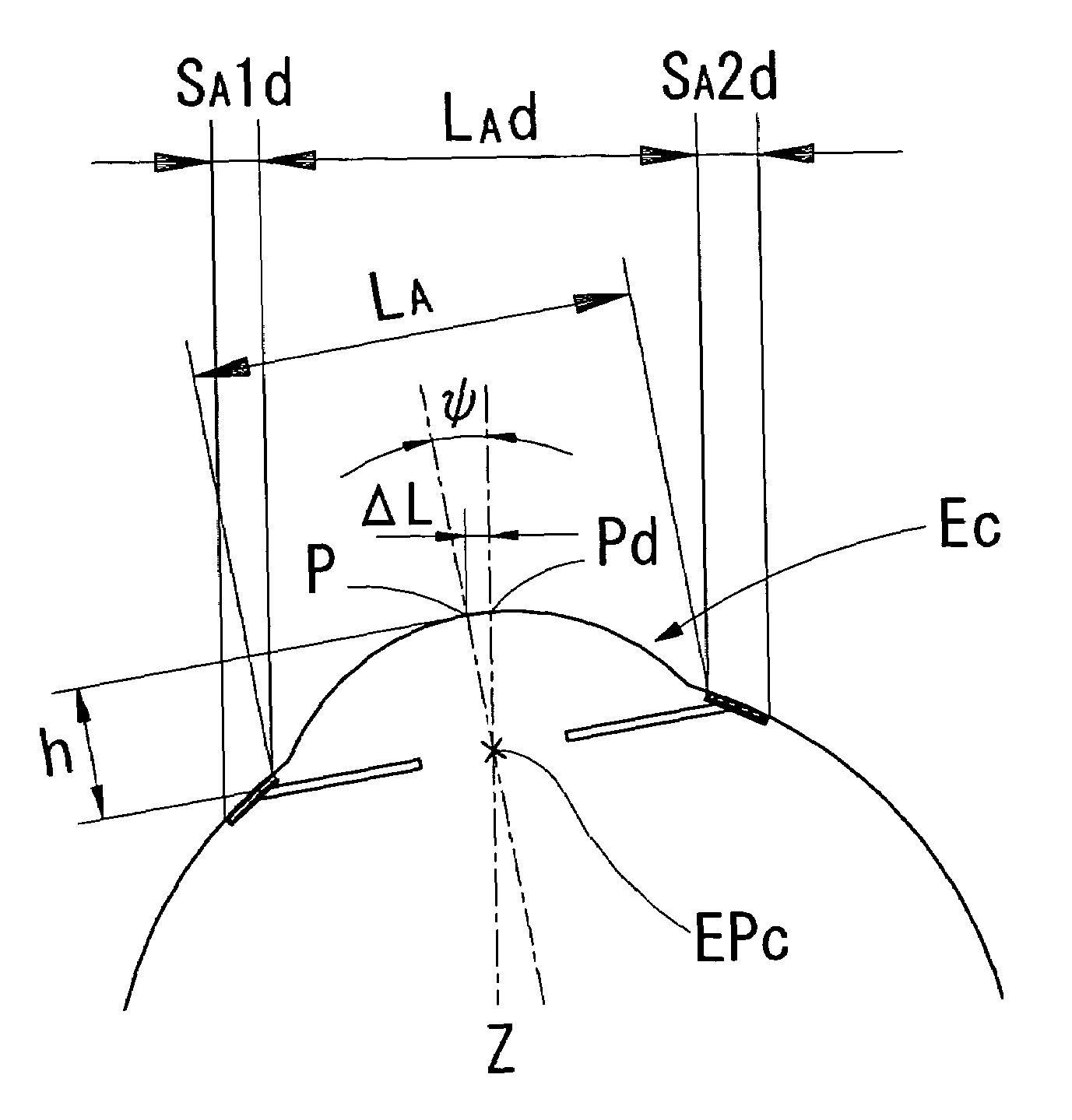 Corneal surgery apparatus