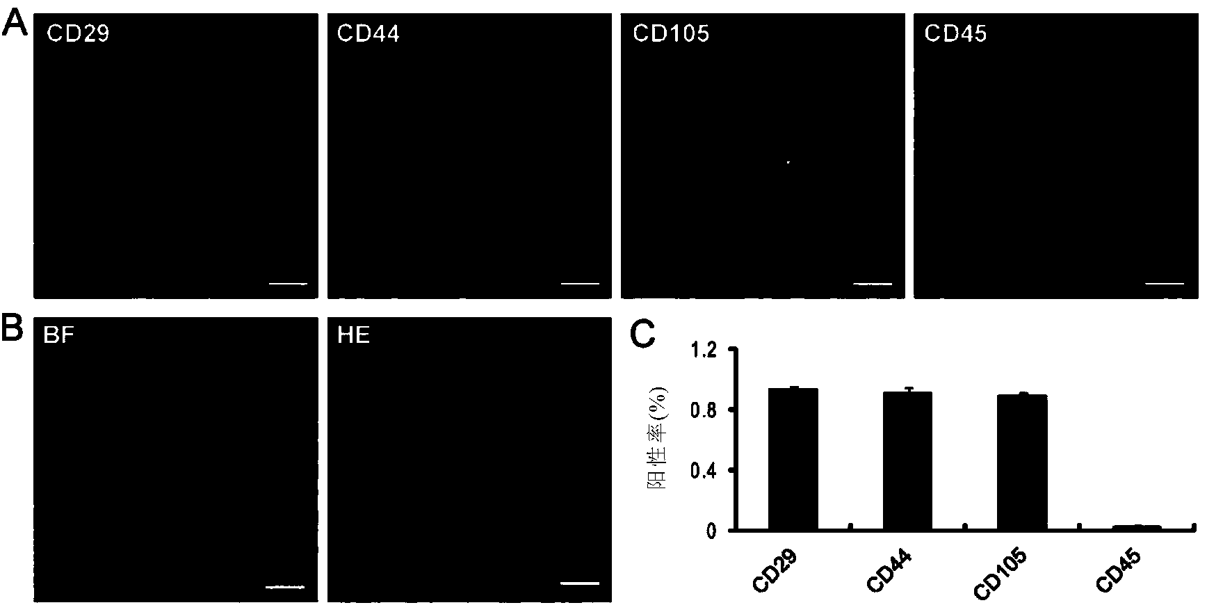 Neuron-like cell sourced from humanized adipose-derived stem cells, preparation method and application thereof