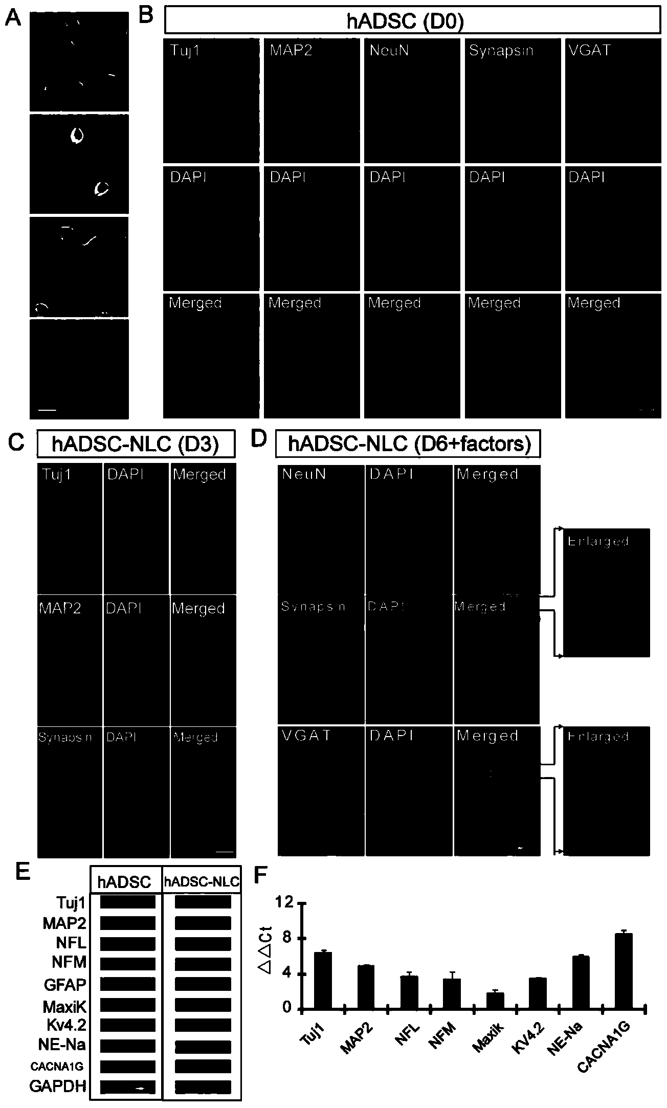 Neuron-like cell sourced from humanized adipose-derived stem cells, preparation method and application thereof