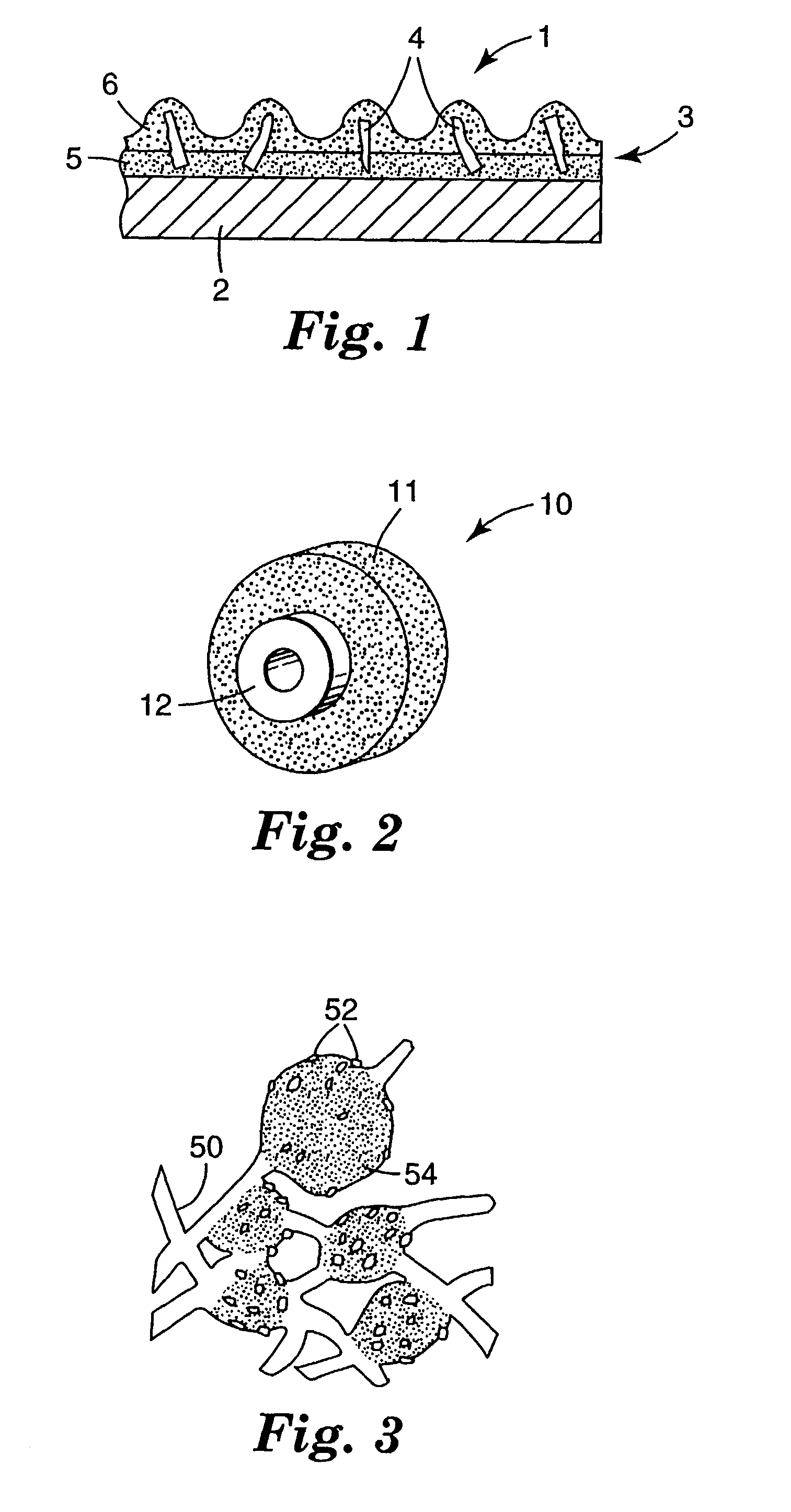Abrasive particles, and methods of making and using the same