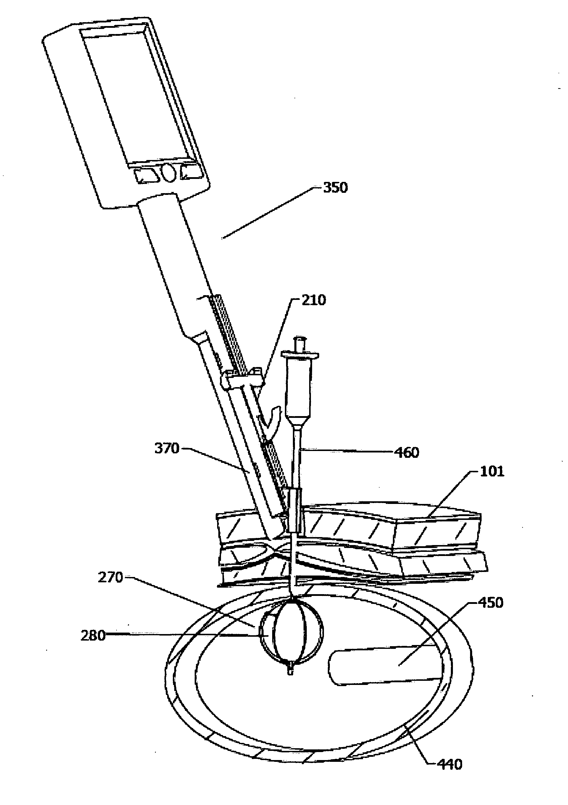 Method and device for ultrasound guided minimal invasive access of a bodily cavity