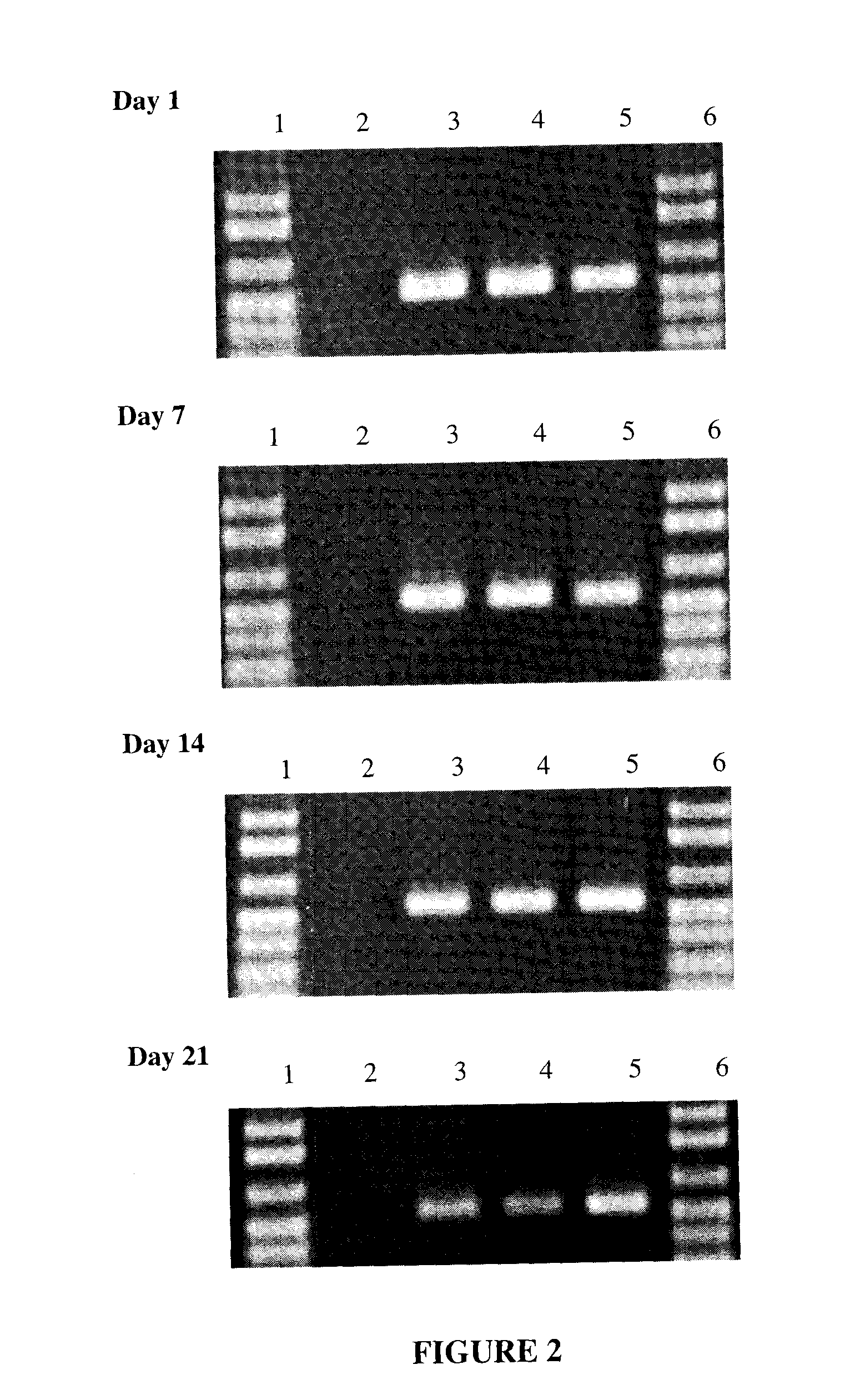 Compositions and Method for Storage of Nucleic Acid From Bodily Fluids