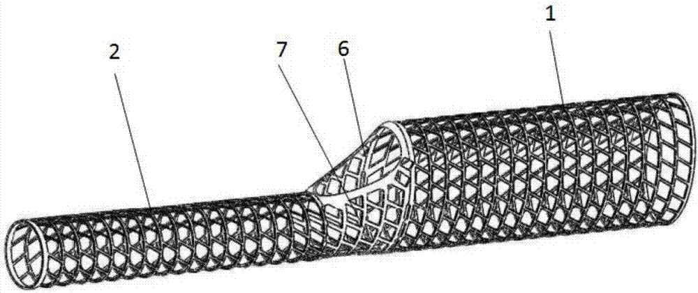 Double-balloon stent with side holes for expandable branch vessels