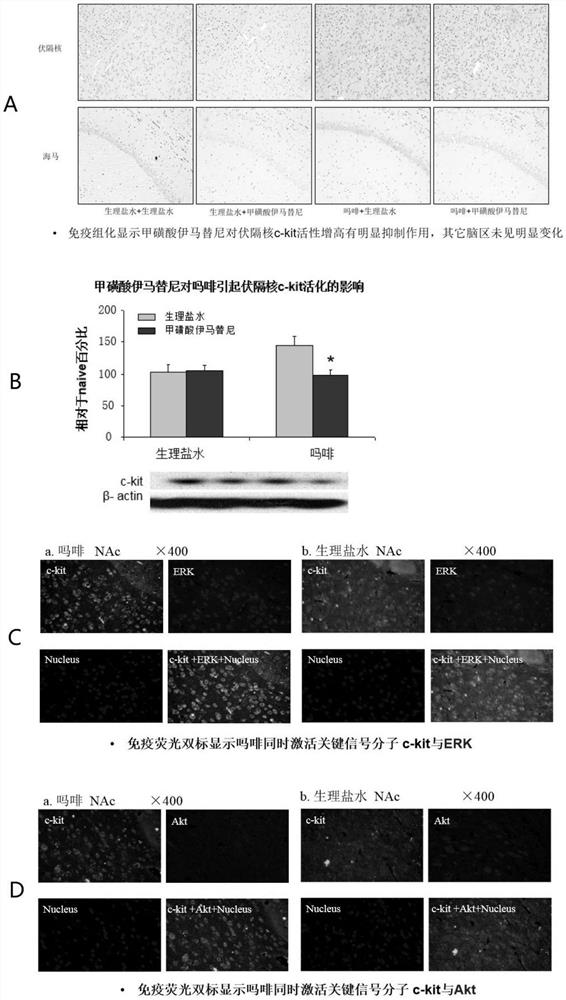 Application of imatinib and derivative thereof and analgesic in combined medication or compound preparation in treatment of pain