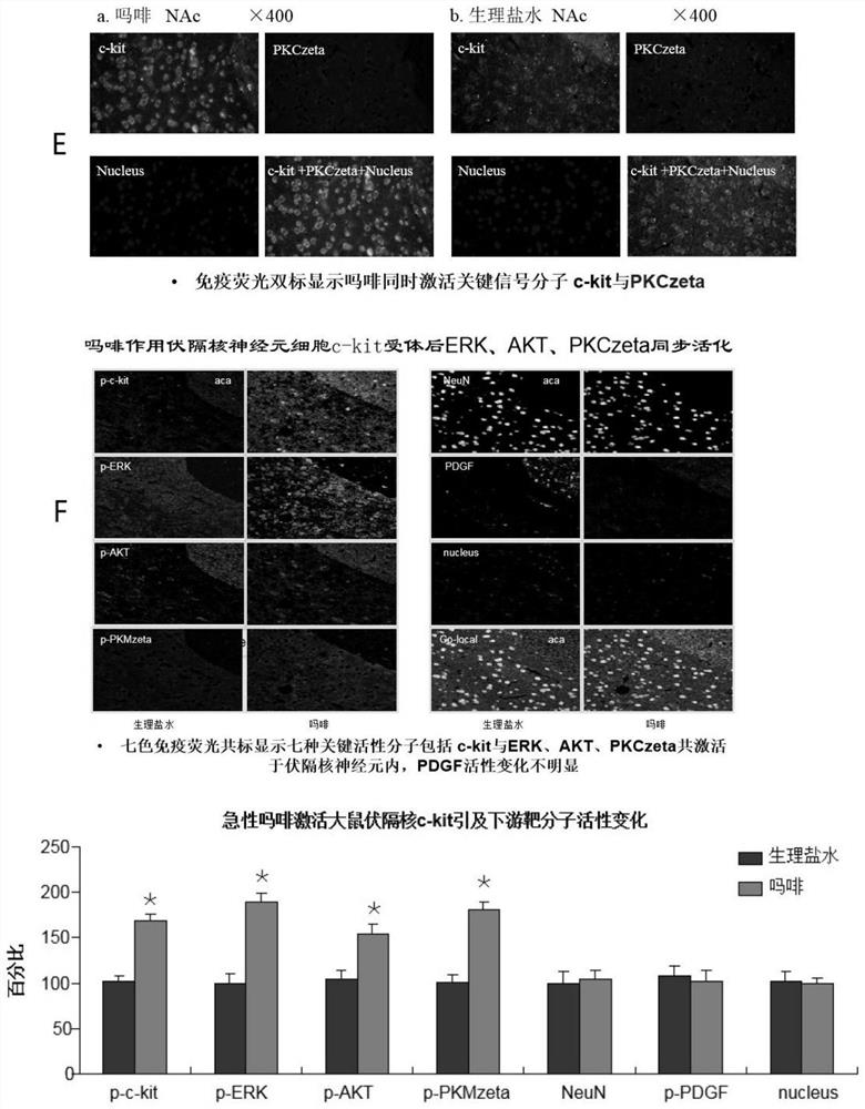 Application of imatinib and derivative thereof and analgesic in combined medication or compound preparation in treatment of pain