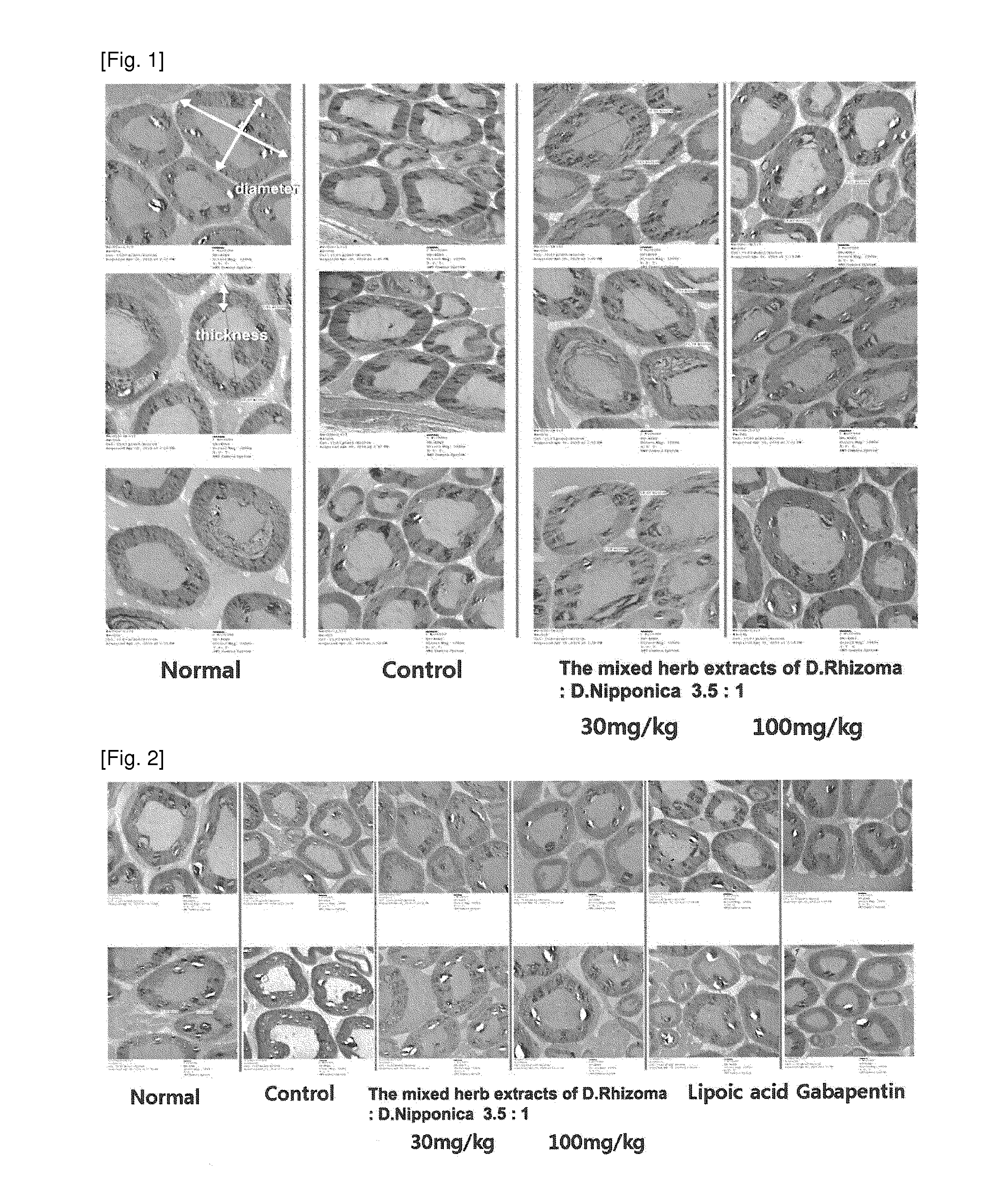 Composition comprising the extract of herbal combination for preventing or treating diabetic peripheral neuropathy