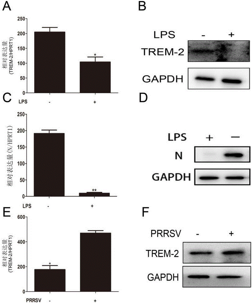 Application of TREM-2 gene in identification of susceptibility of pigs to reproductive and respiratory syndrome virus