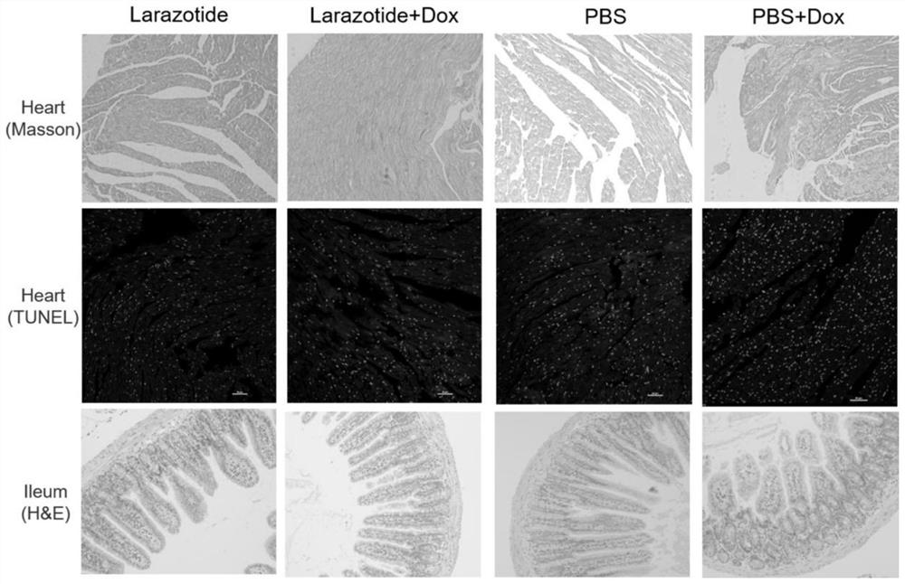 Application of laurazolette polypeptide in preparation of medicine for relieving doxorubicin cardiotoxicity