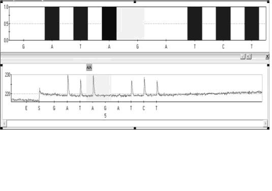 Kit and method for detecting gene polymorphism capable of influencing mercaptopurine personalized medications by means of pyro sequencing method