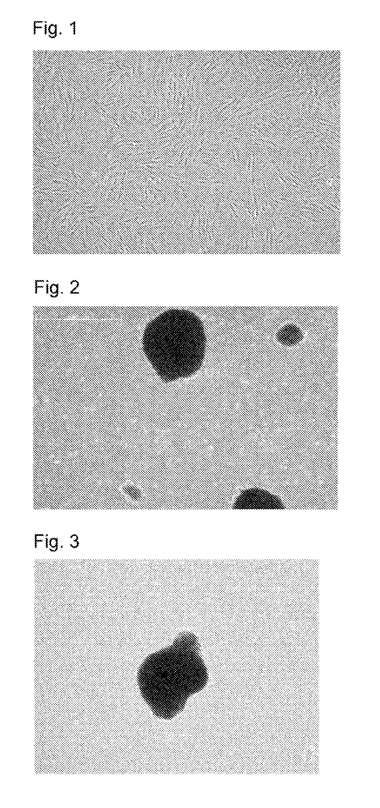 Method for production of hepatic-lobule-like cell cluster from adipose-tissue-derived cell