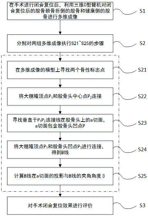 Femoral neck fracture closed reduction evaluation method and system based on three-dimensional C-type arm machine