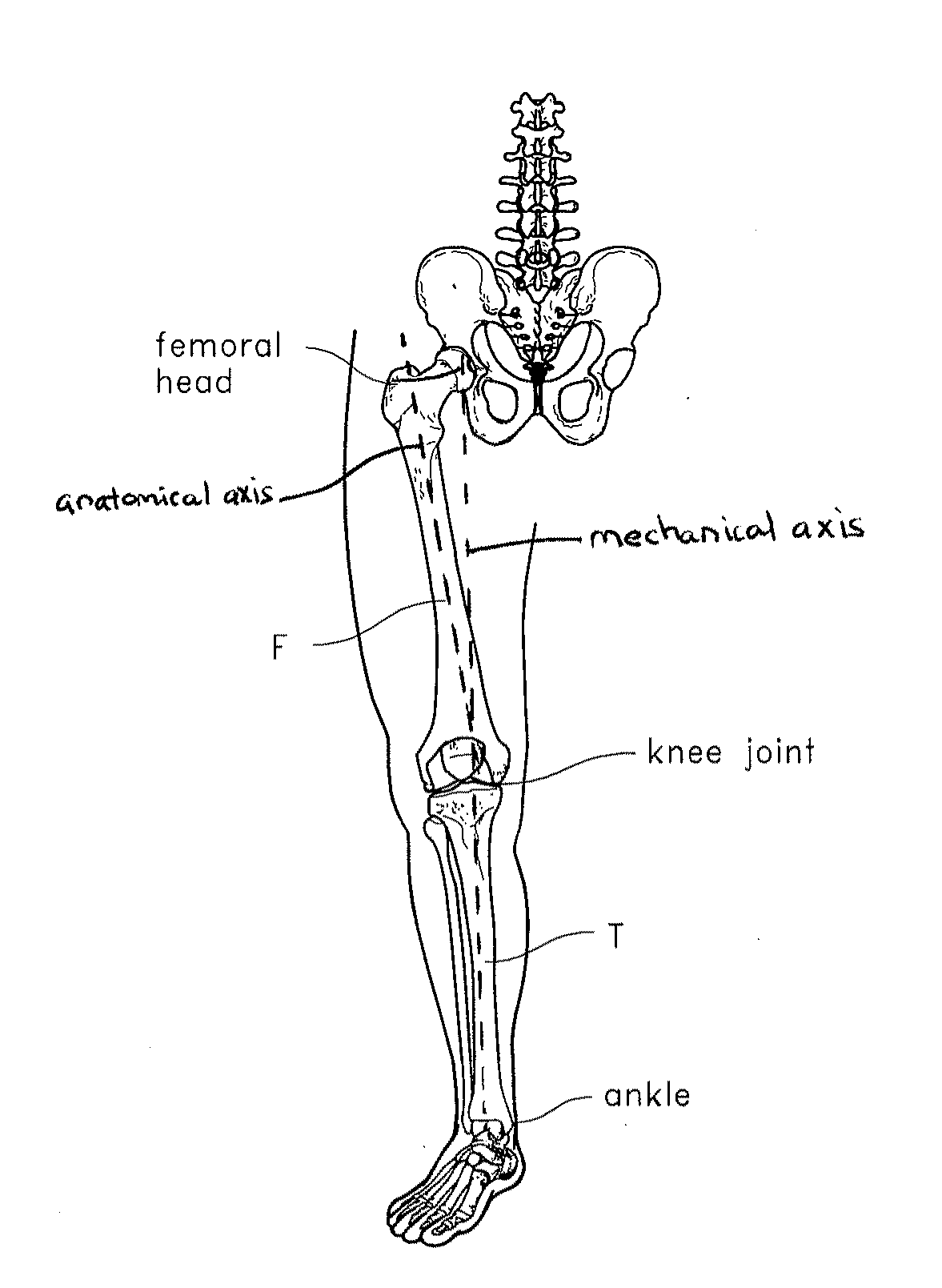 Systems and methods for joint replacement