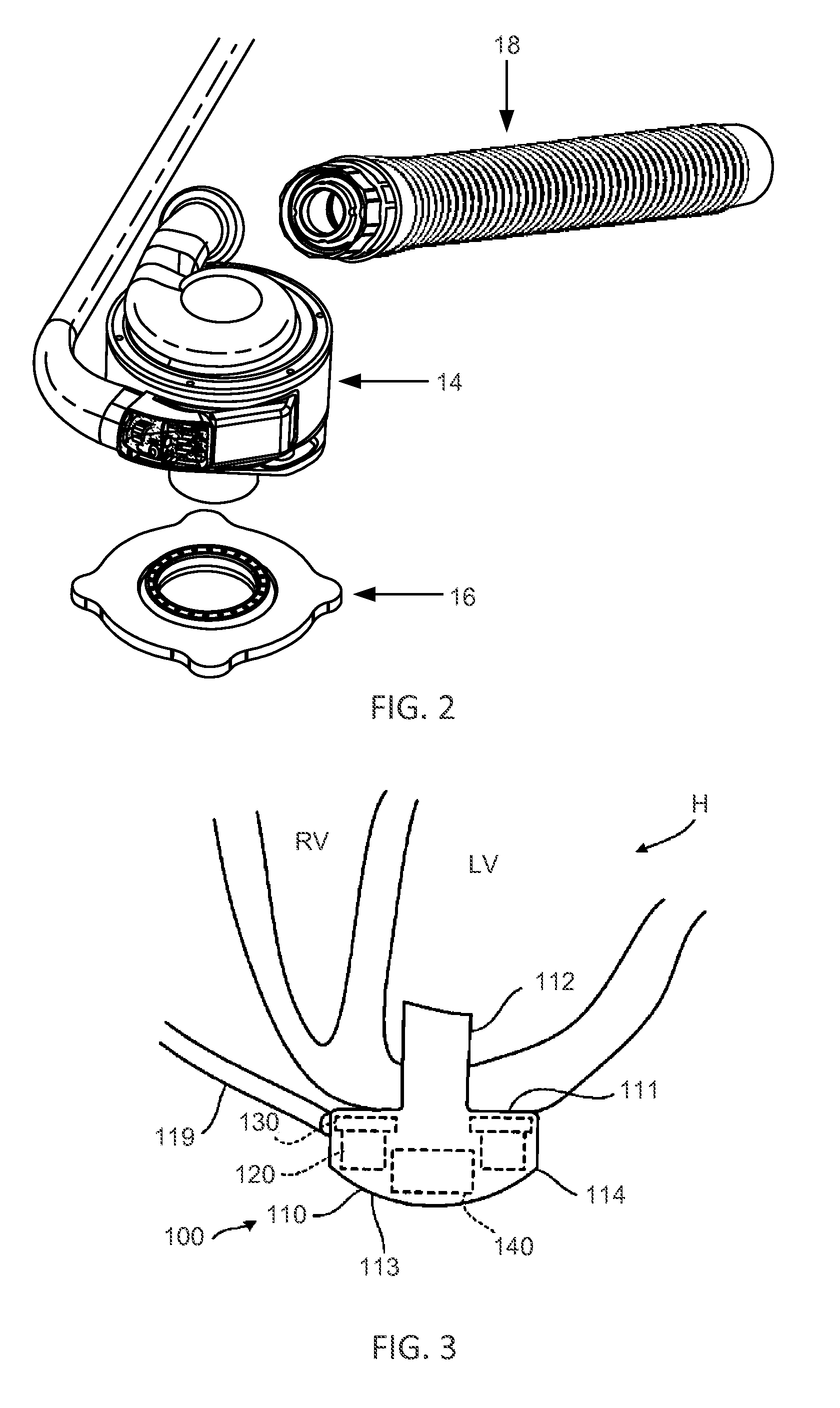 Methods and Systems for Controlling a Blood Pump