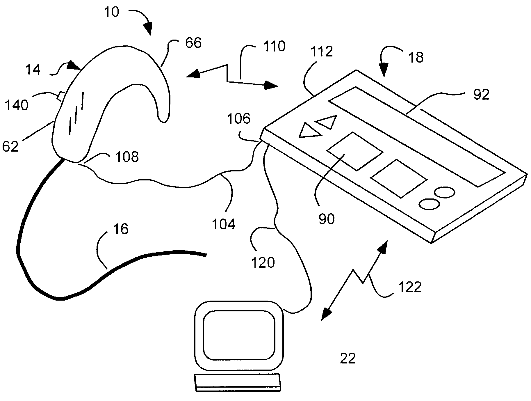 Cochlear drug delivery system and method