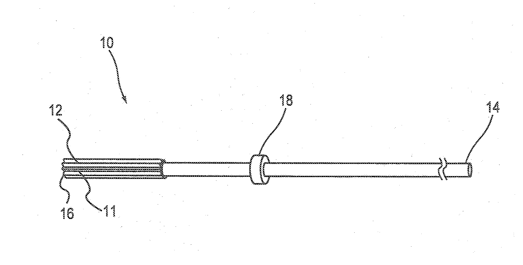 Catheter design for use in treating pleural diseases