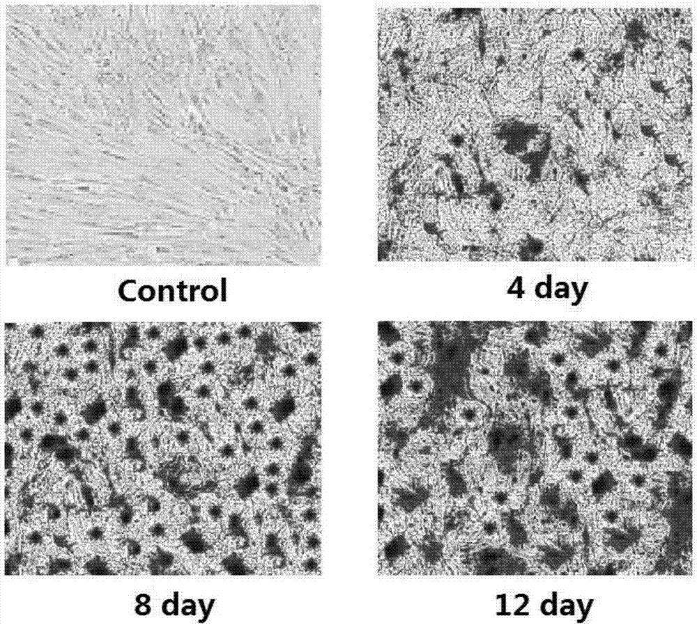 Applications of non-coding RNA target and inhibitor thereof in preparing medicines capable of promoting osteogenic differentiation of mesenchymal stem cells