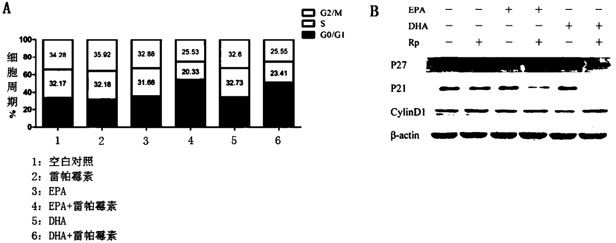 Application of pharmaceutical composition of rapamycin type drugs and omega-3 fatty acid to preparation of drugs for treating kidney cancer