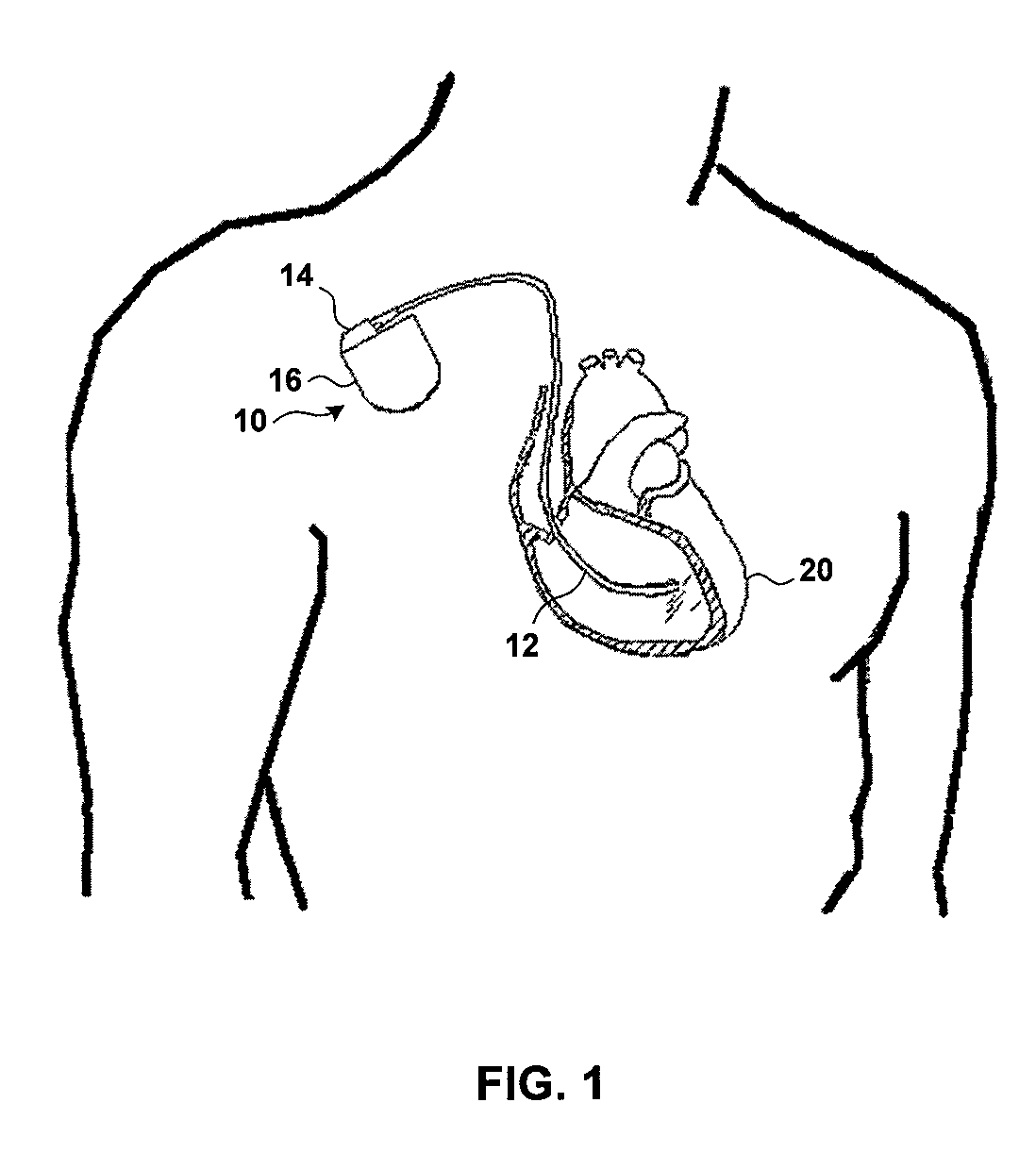 Organizing data according to cardiac rhythm type