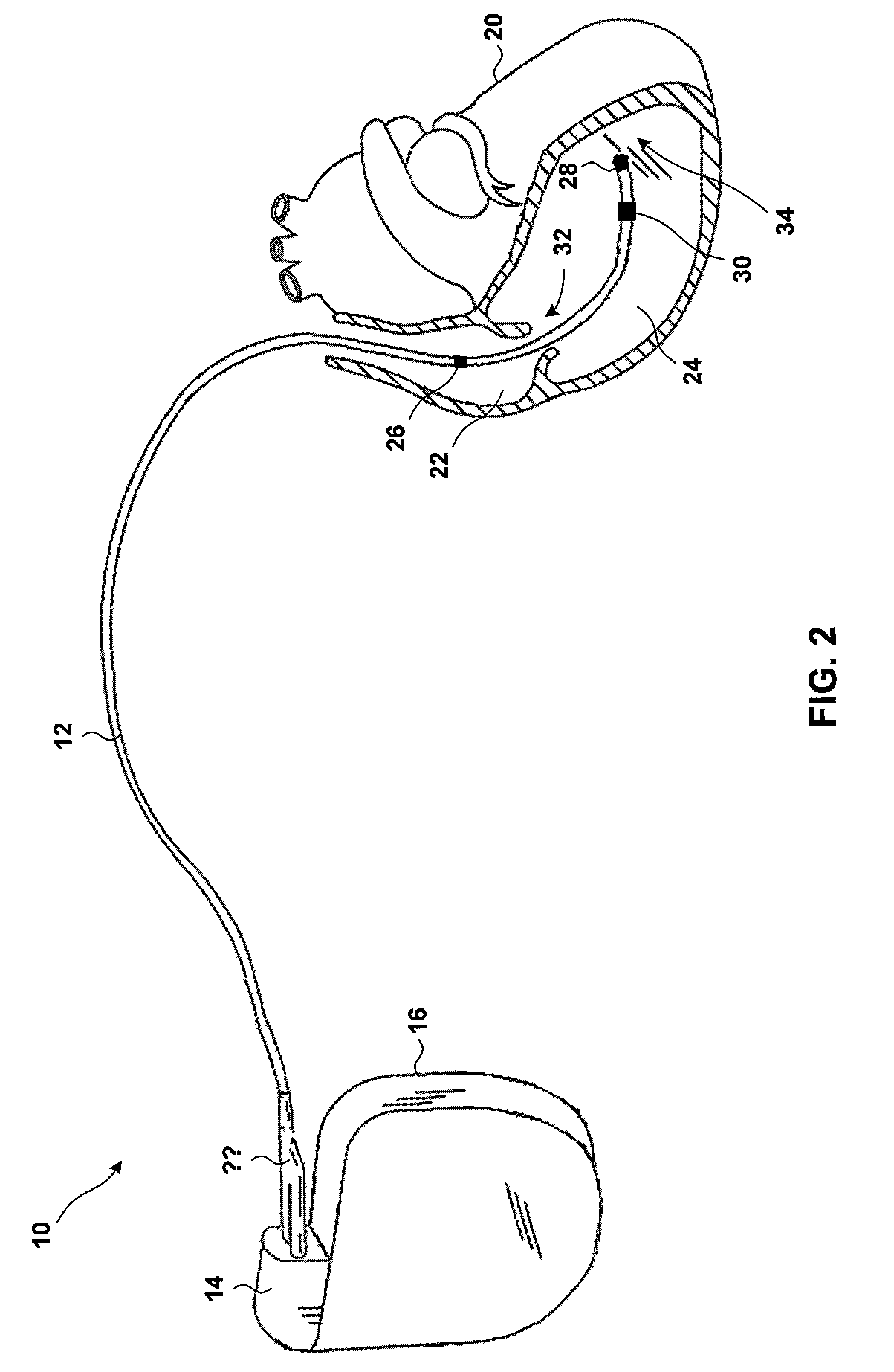 Organizing data according to cardiac rhythm type