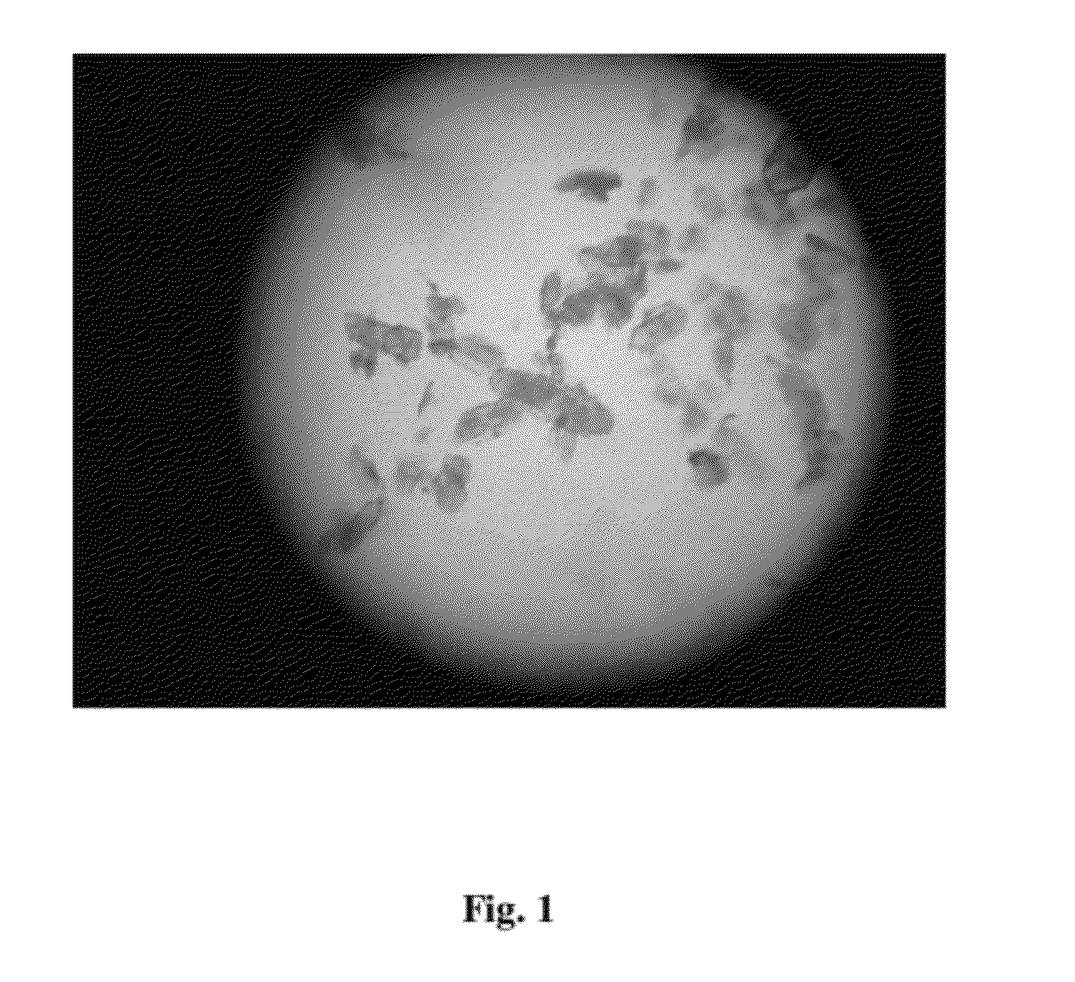 Polymorphs of Dasatinib, preparation methods and pharmaceutical compositions thereof