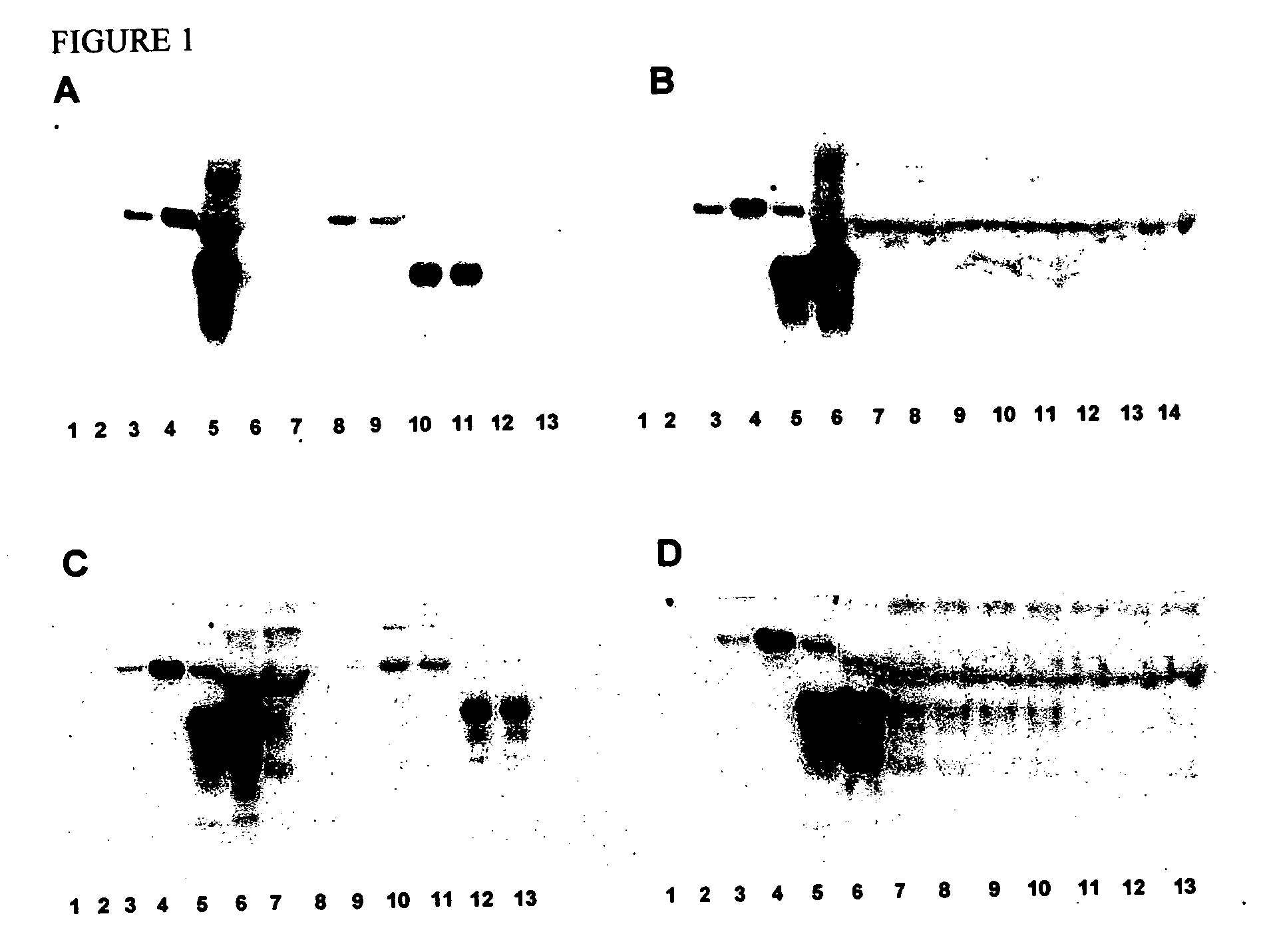 Prion protein binding materials and methods of use