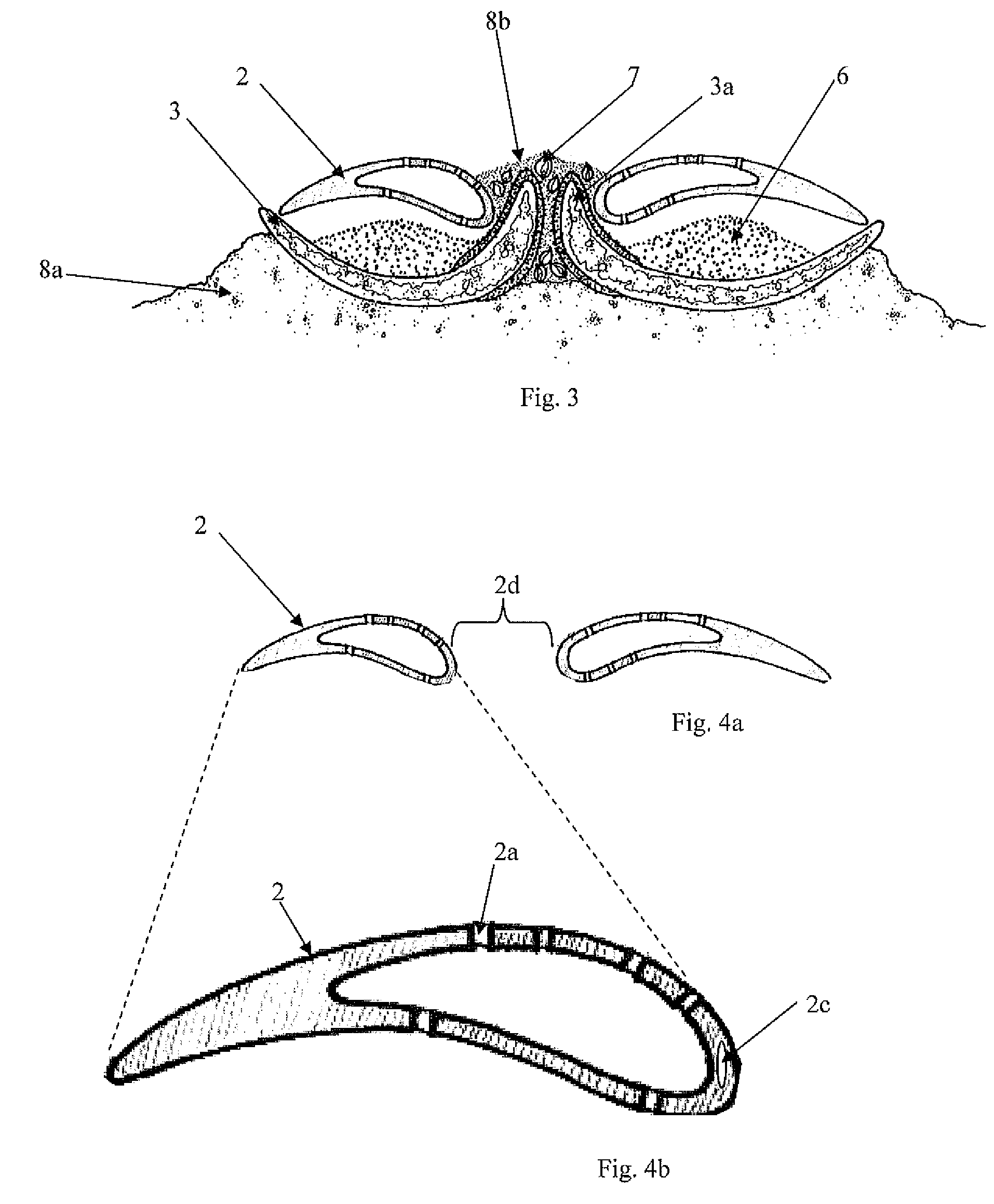 Method and apparatus for ecological burial