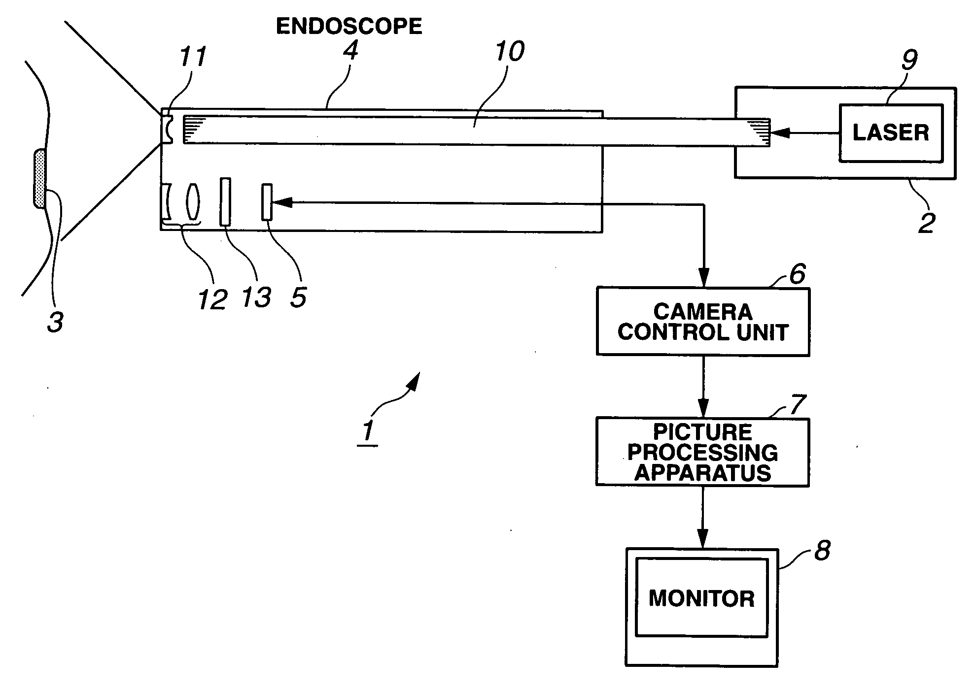 Fluorescence observation endoscope apparatus and fluorescence observation method
