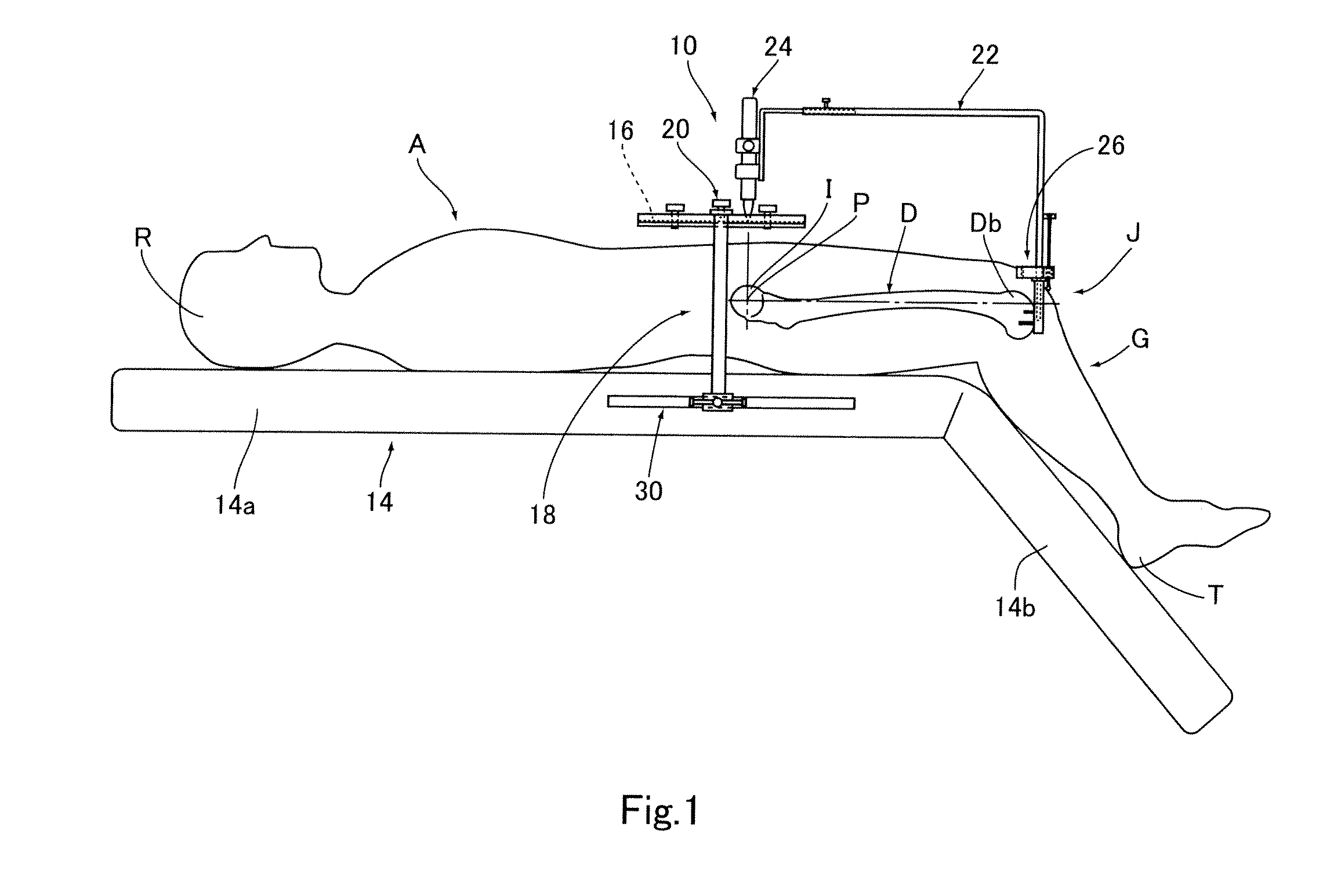 Apparatus for identifying femoral head center