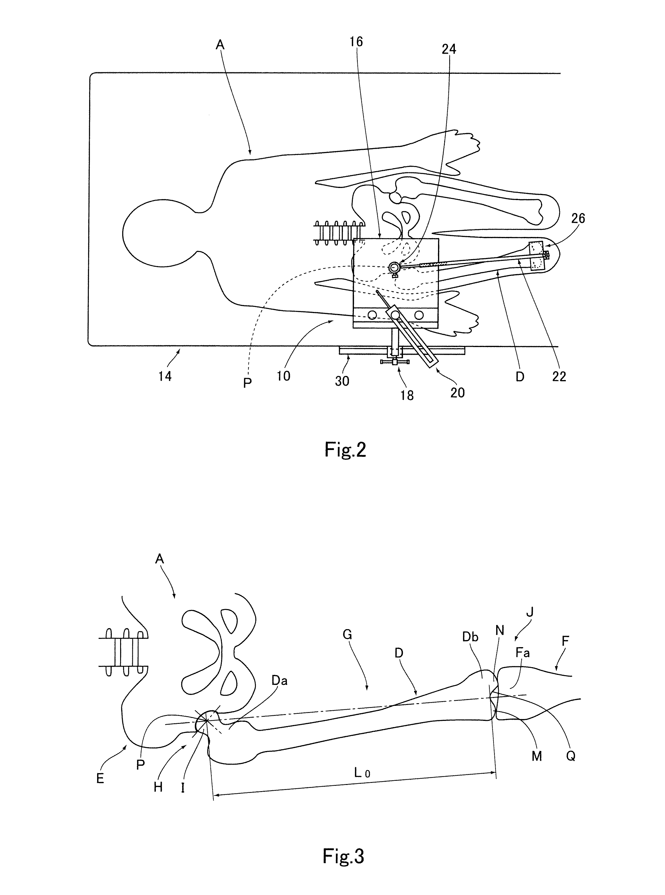 Apparatus for identifying femoral head center
