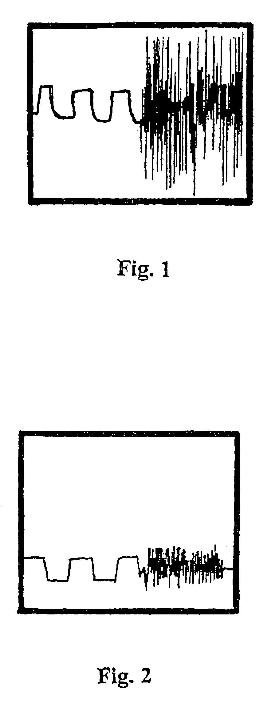 Plastically deformable implant