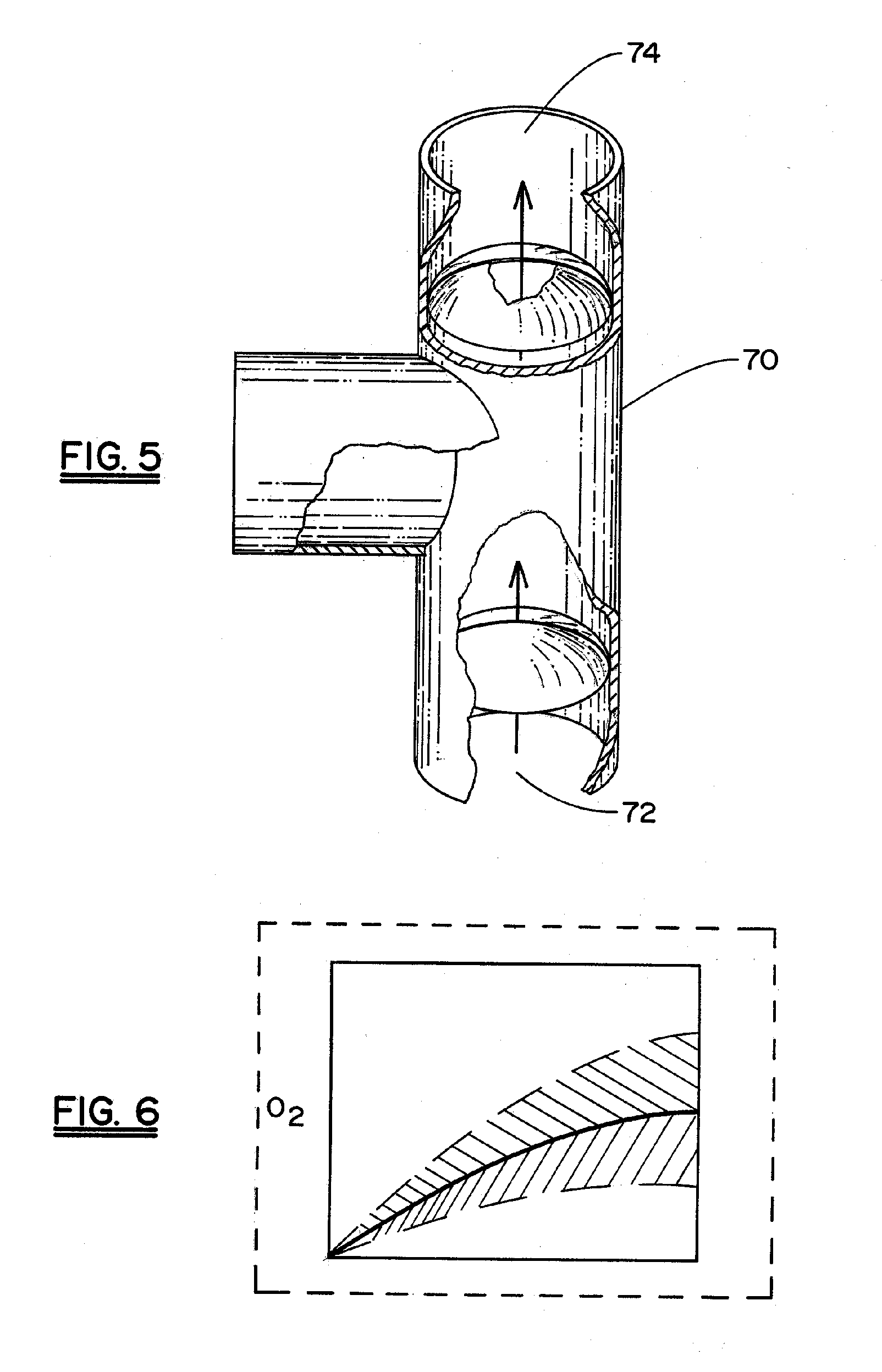 Non-Invasive Device and Method for Measuring the Cardiac Output of a Patient