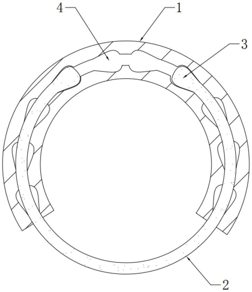 Flexible esophageal stent with nested structure