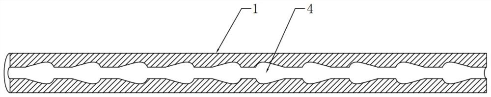 Flexible esophageal stent with nested structure