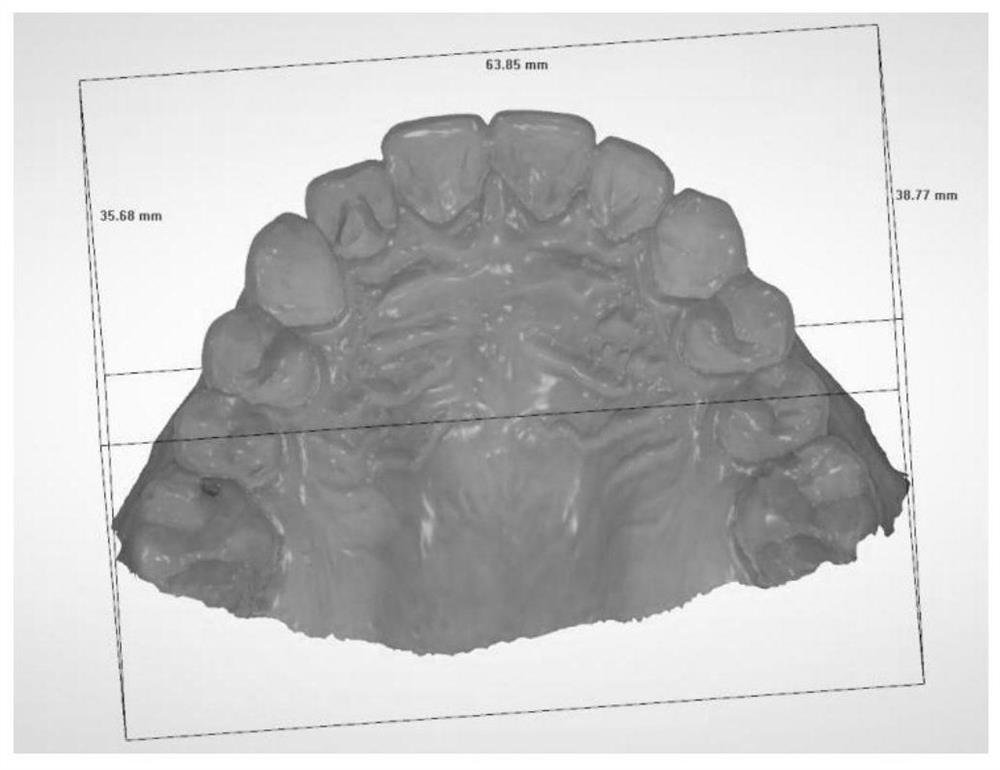 Three-dimensional palatal wrinkle recognition method based on fractional Fourier transform