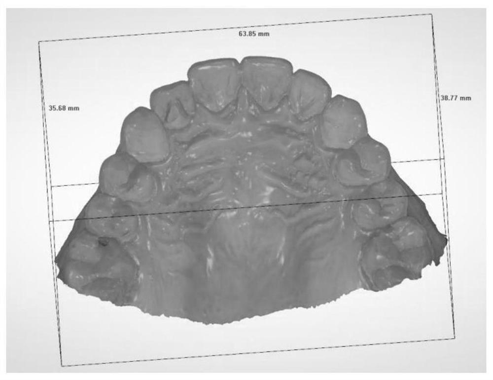 Three-dimensional palatal wrinkle recognition method based on fractional Fourier transform
