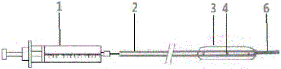 Plugging device capable of injecting hydrogel for ureteroscope lithotripsy