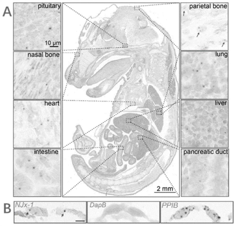 Higher eukaryote non-intron nested gene NJx-1 and expression protein and application thereof